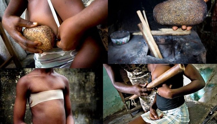 Breast-Ironing ten news