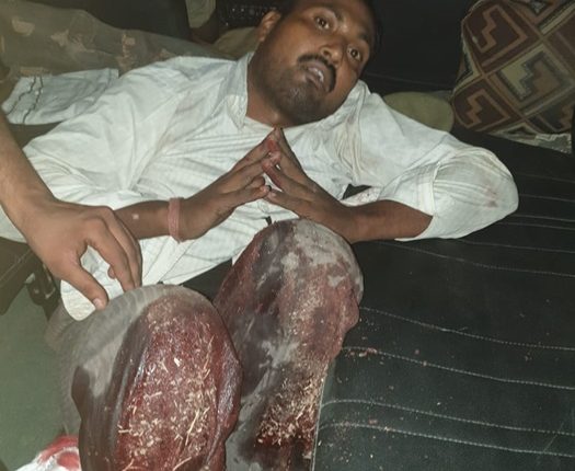 नोएडा पुलिस व बदमाशों के बीच हुई मुठभेड़ , 25-25 हजार के दो बदमाश घायल